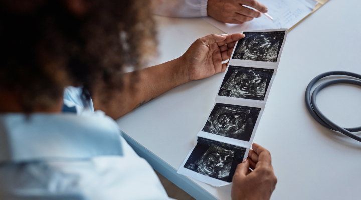 PFD banner image - woman looking at ultrasound images